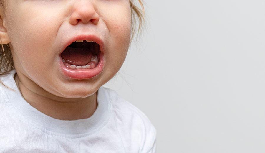 Menina chorando com dor de dente