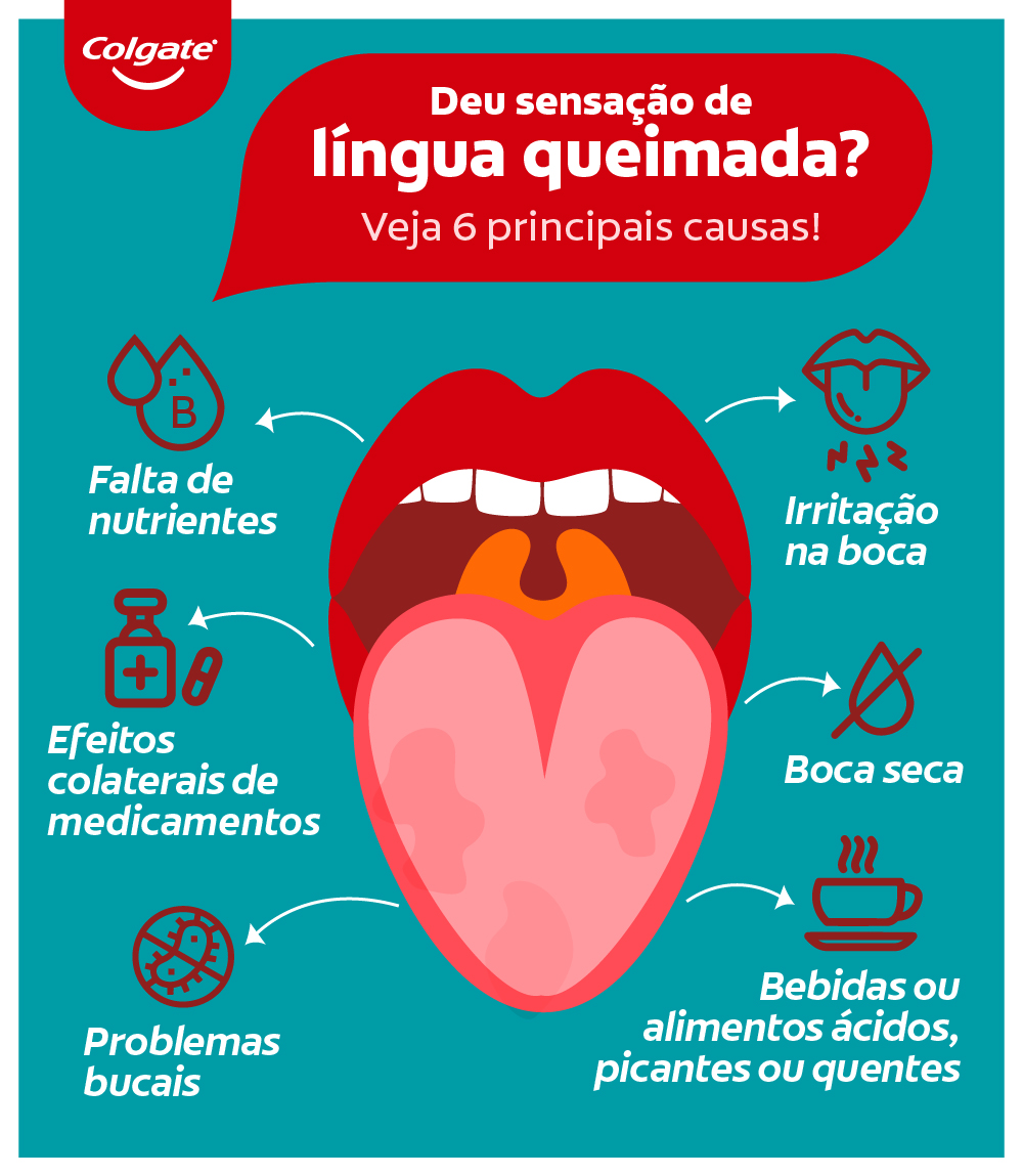 Infográfico explicando as causas da sensação de língua queimando